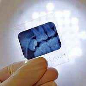 Odontologo implantes